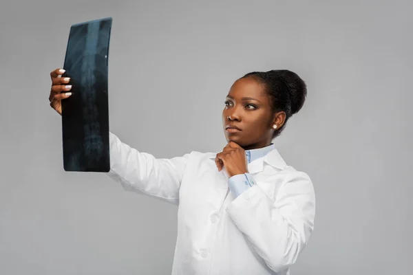 Afro-américaine femme médecin à la recherche de rayons X — Photo