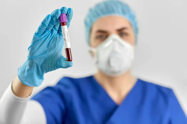 Médico segurando copo com coronavírus teste de sangue — Fotografia de Stock