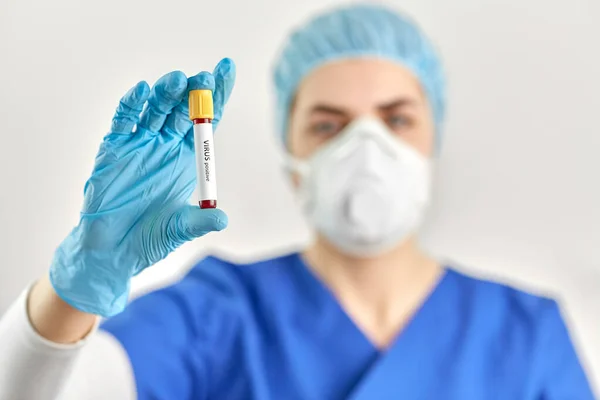 Médico sosteniendo vaso de precipitados con análisis de sangre del virus — Foto de Stock