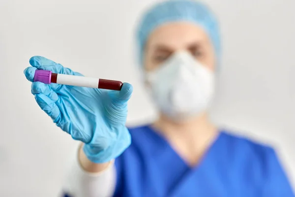 Primer plano del médico sosteniendo el vaso de precipitados con análisis de sangre —  Fotos de Stock