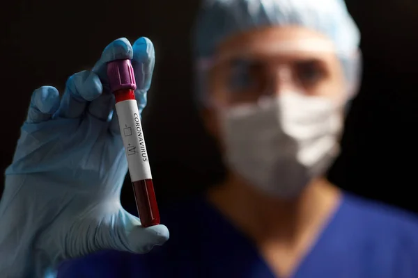 Médico segurando copo com coronavírus teste de sangue — Fotografia de Stock