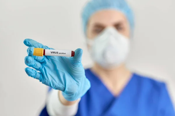 Medico che tiene becher con esame del sangue del virus — Foto Stock