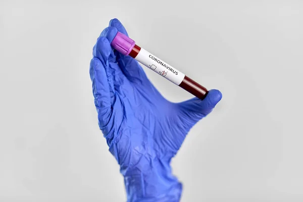 Handbekerglas met coronavirus bloedtest — Stockfoto