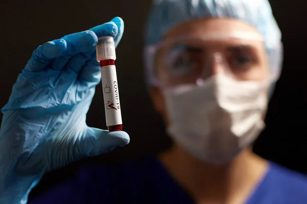 Médico segurando copo com coronavírus teste de sangue — Fotografia de Stock