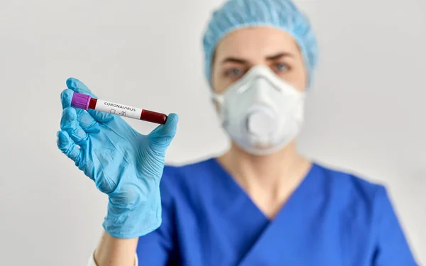 Doctor holding beaker with coronavirus blood test — Stock Photo, Image