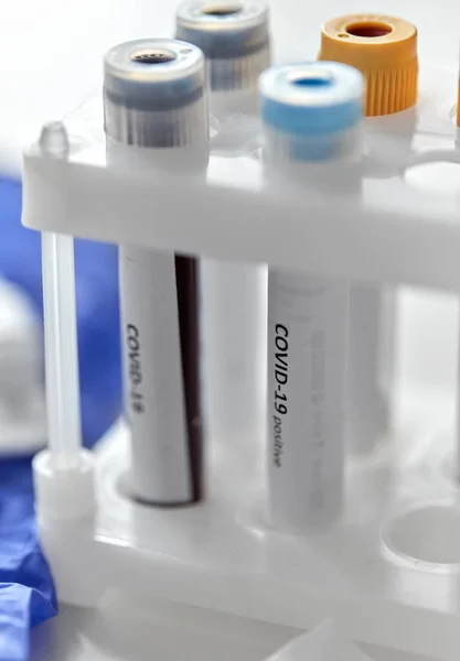 Beakers with coronavirus blood test in holder — Stock Photo, Image