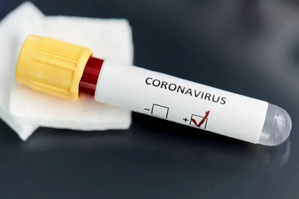 Bekerglas met coronavirus bloedtest in het laboratorium — Stockfoto