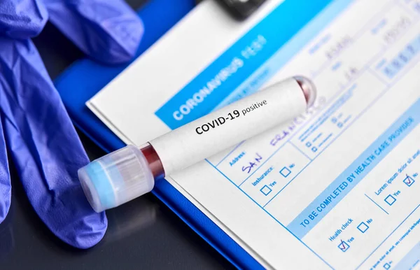 Close up of beaker with coronavirus blood test — Stock Photo, Image