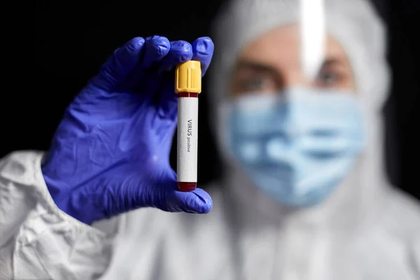 Cientista segurando copo com teste de sangue do vírus — Fotografia de Stock