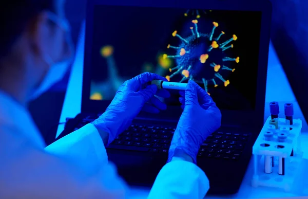 Vaso de precipitados con análisis de sangre de coronavirus — Foto de Stock