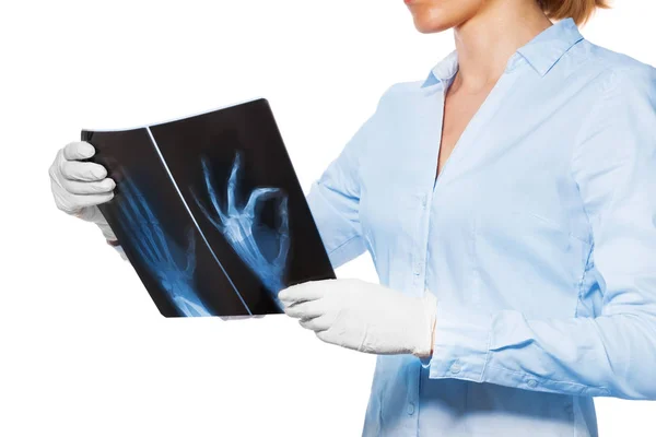 Γυναίκα γιατρό κρατώντας ακτινογραφία σαρώνει — Φωτογραφία Αρχείου