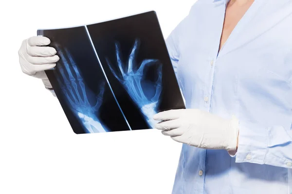 X 線を保持している女医をスキャンします。 — ストック写真