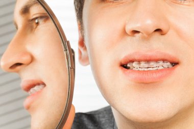man with orthodontic braces near mirror clipart