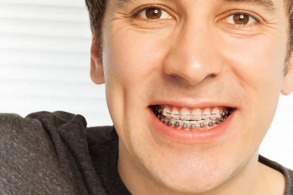 Szczęśliwy młody człowiek z aparatów na zęby — Zdjęcie stockowe