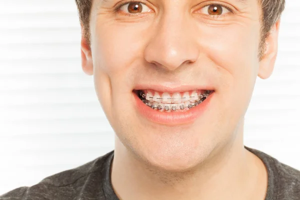 Happy young man with dental braces — Stock Photo, Image