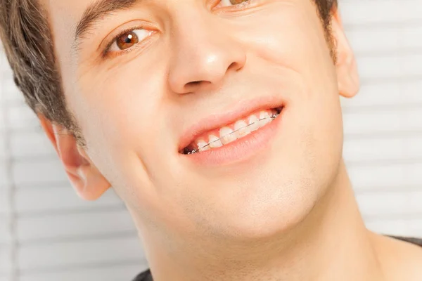 Smiling young man with dental braces — Stock Photo, Image
