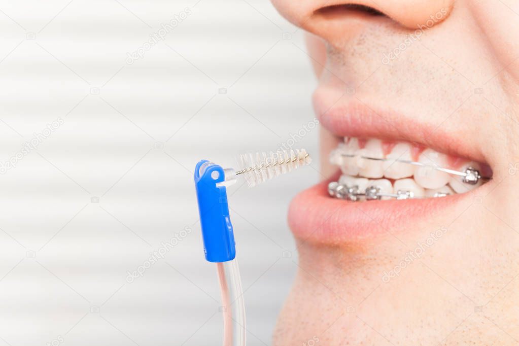 Man cleaning orthodontic braces with brush