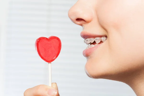 Perfil Mujer Con Ortodoncia Ortodóncica Sosteniendo Piruleta Roja Forma Corazón —  Fotos de Stock