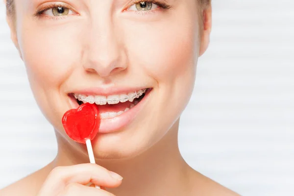 Closeup Portrait Beautiful Young Woman Dental Braces Biting Red Lollipop — Stock Photo, Image