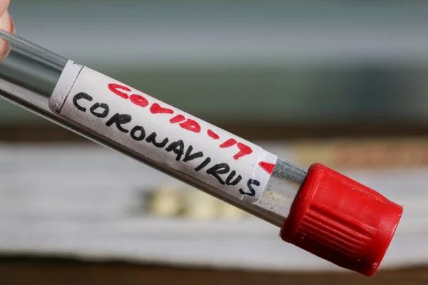 Coronavirus takma adı Covid. Kan tüpü üzerinde 19 metin.