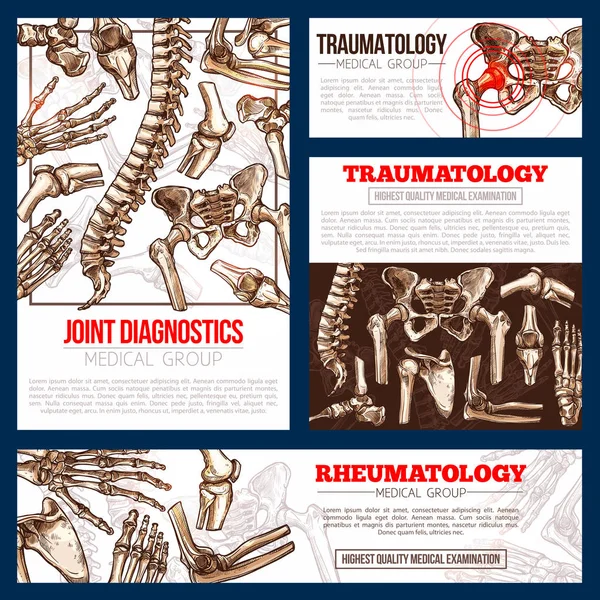 Plantilla de banner médico conjunto de hueso, radiografía de articulaciones — Archivo Imágenes Vectoriales