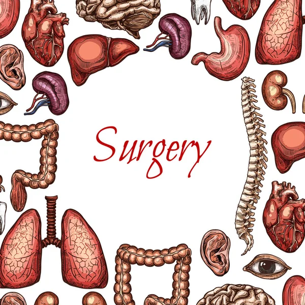 Cartel de cirugía con órgano humano, bosquejo de partes del cuerpo — Vector de stock