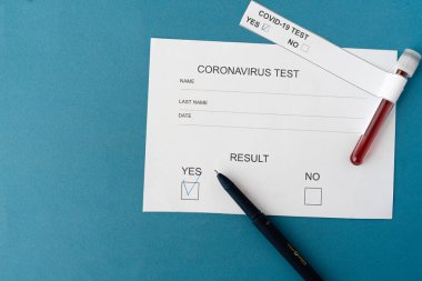 Masanın üzerinde üzerinde üzerinde kan örnekleri olan bir test tüpü var. Koronavirüs ve enfeksiyon testi sonuçları..