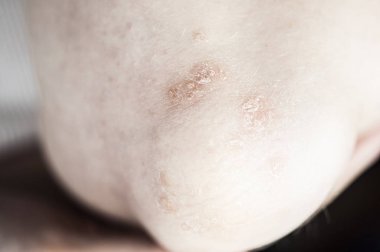 kadın boğaz dirsek