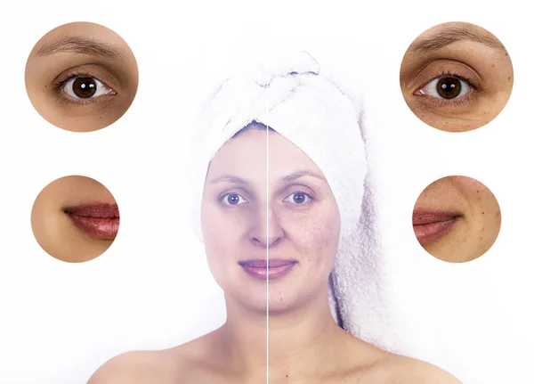 Gezicht Van Vrouw Schoonheidsconcept Huidverzorging Aging Procedures Verjonging Tillen Aanscherping — Stockfoto