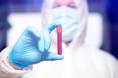 COVID-19 - Coronavirus hastalığı - 2019-nCoV. Doktor, Covid-19 enfeksiyon analizi ve numunesi için kan örneği tutuyor..