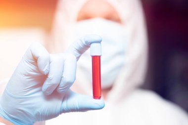 COVID-19 - Coronavirus hastalığı - 2019-nCoV. Doktor, Covid-19 enfeksiyon analizi ve numunesi için kan örneği tutuyor..