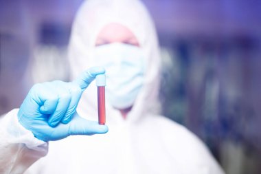 COVID-19 - Coronavirus hastalığı - 2019-nCoV. Doktor, Covid-19 enfeksiyon analizi ve numunesi için kan örneği tutuyor..