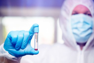 COVID-19 - Coronavirus hastalığı - 2019-nCoV. Doktor, Covid-19 enfeksiyon analizi ve numunesi için kan örneği tutuyor..