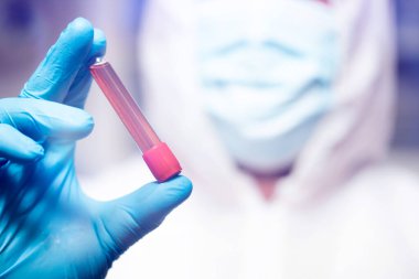 COVID-19 - Coronavirus hastalığı - 2019-nCoV. Doktor, Covid-19 enfeksiyon analizi ve numunesi için kan örneği tutuyor..