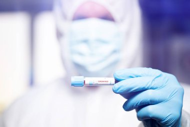 COVID-19 - Coronavirus hastalığı - 2019-nCoV. Doktor, Covid-19 enfeksiyon analizi ve numunesi için kan örneği tutuyor..