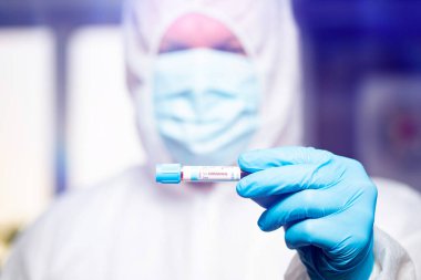 COVID-19 - Coronavirus hastalığı - 2019-nCoV. Doktor, Covid-19 enfeksiyon analizi ve numunesi için kan örneği tutuyor..