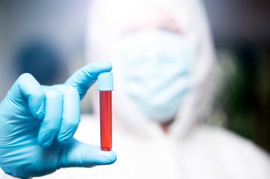 COVID-19 - Coronavirus hastalığı - 2019-nCoV. Doktor, Covid-19 enfeksiyon analizi ve numunesi için kan örneği tutuyor..