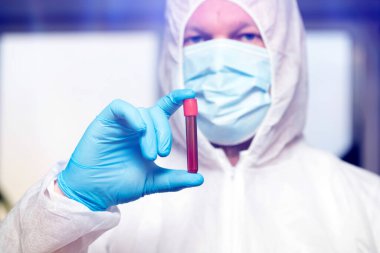 COVID-19 - Coronavirus hastalığı - 2019-nCoV. Doktor, Covid-19 enfeksiyon analizi ve numunesi için kan örneği tutuyor..