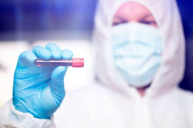 COVID-19 - Coronavirus hastalığı - 2019-nCoV. Doktor, Covid-19 enfeksiyon analizi ve numunesi için kan örneği tutuyor..