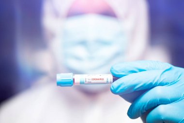 COVID-19 - Coronavirus hastalığı - 2019-nCoV. Doktor, Covid-19 enfeksiyon analizi ve numunesi için kan örneği tutuyor..