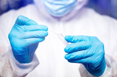 COVID-19 - Coronavirus hastalığı - 2019-nCoV. Doktor, Covid-19 enfeksiyon analizi ve numunesi için kan örneği tutuyor..