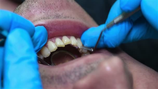 Дантист проверяет рот пациента — стоковое видео