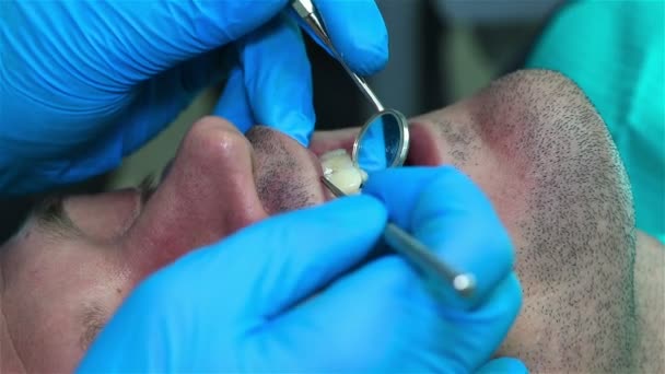 Дантист проверяет зуб пациента в клинике. Закрыть — стоковое видео