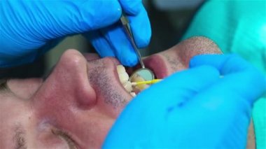 Mavi eldiven diş hekimi diş Implant hasta koyar