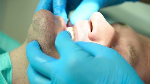 Un dentista che esamina un paziente. Ridurre la mascella di un paziente — Video Stock