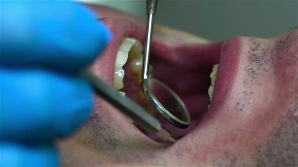 El dentista examina los dientes usando el espejo oral. Efecto de cámara lenta — Vídeo de stock