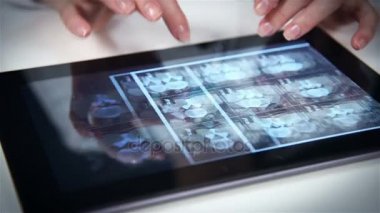 Doktor Röntgen Tablet ekranında omurganın inceliyor