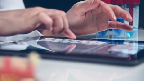 Wetenschapper onderzoekt een röntgenfoto van de patiënt op de Tablet. Close-up — Stockvideo