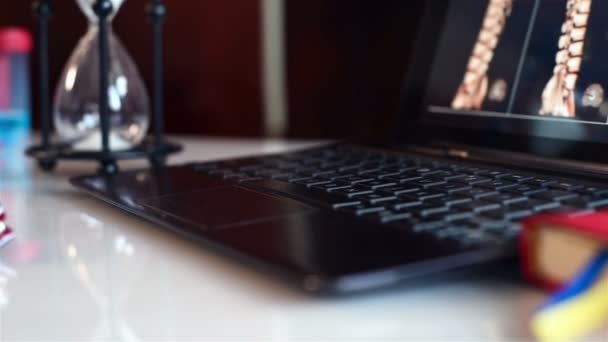 Zdravotní karta pacienta a Laptop s rentgeny páteře na obrazovce. Pracovní stůl terapeut. — Stock video