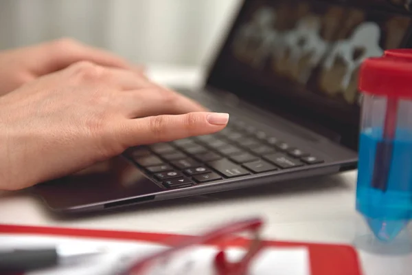 Doctor hands typing on laptop — Stock Photo, Image